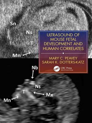 cover image of Ultrasound of Mouse Fetal Development and Human Correlates